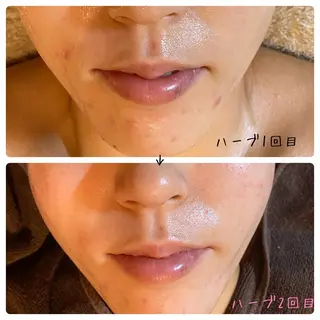 fairyrose organicエステのエステ・リラクイメージ