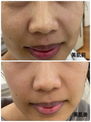 デアイム甲府所属・つかだ りょうこのエステ・リラクイメージ