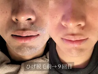 脱毛サロン Arumのエステ・リラクイメージ