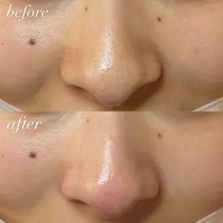seReno KOHAKUの眉毛・アイブロウイメージ