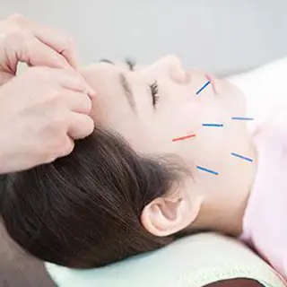 鍼灸治療室　Crysta所属・痣にならないヒト幹細 胞美容鍼/坂井里帆のその他イメージ