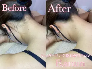 マツエク・マツパ シュガーリング脱毛 専門店Ranunのエステ・リラクイメージ