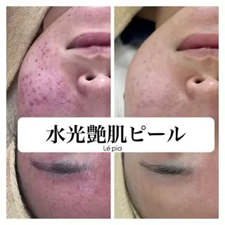 肌質管理専門店 Lé pia　AMIのエステ・リラクイメージ