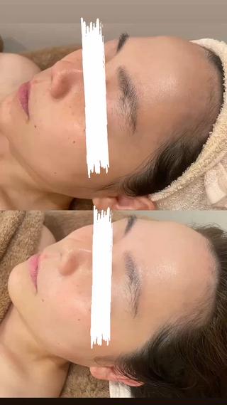 加工なしですくすみがとびお肌に透明感が
マッサージは得意なのでぜひ1度お試しください 