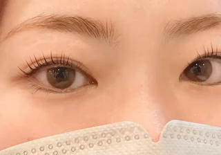 上まつげパリジェンヌラッシュリフト
パッチリお目元に 