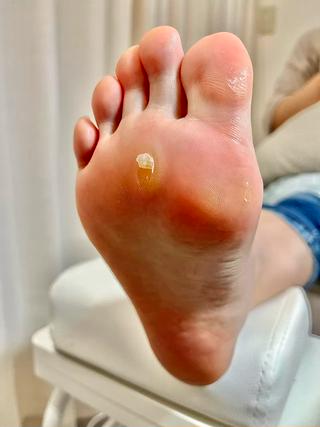 追加メニュー　フットスパ(たこ・角質除去)¥3,000
 