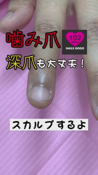 噛み爪スカルプできます
さきに自爪のお写真dm下さい

渋谷ネイルサロンNAILSGOGO 03-5728-4343 

渋谷センター街ZARA目の前3階 