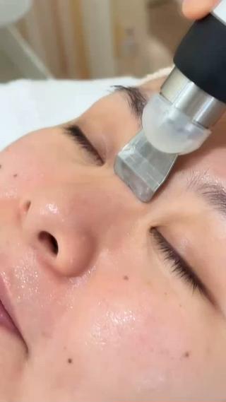 皮脂抑制、ニキビ予防のジェルに超音波の力で、汚れが浮き上がるともともと透明だったジェルが白っぽくなります。
つるんと一皮剥けたような卵肌に
 