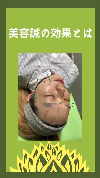 こんばんは！
蓮花鍼灸整骨院の飯田です！

本日は美容鍼についてのお話です！
少しでも美容鍼について気になっている方は是非ご覧になってくださいね

美容鍼の鍼はとても細い物を使うので、痛さは少なくなっているので、安心ですね
よく耳にするターンオーバーけど、ターンオーバーって何？ってなっていませんか？

https://instagram.com/hashuhana.tiryo?igshid=YmMyMTA2M2Y=
気になったらこちらをチェック！

また、やってみたいと思った方は、ご予約どしどしお待ちしております

ーーーーーーーーーーーーーーーーーー
営業時間　水曜日、日曜日
9:00〜20:00

お電話でのご予約はこちら
08060986185
お電話でのご予約が施術中などで繋がりにくくなっている場合もございます

LINEでのご予約はこちら
https://lin.ee/rBPTbSB
ミニモからもご予約可能です
「予約する」のボタンを押してくださいね

#蓮花鍼灸整骨院#鍼灸#矯正#姿勢改善
#姿勢#トレーニング#美容鍼
#フェイシャルマッサージ#フェイシャルライン#個室#整骨院#門真市#御堂町#古川橋駅#ターンオーバー#人気#腰痛#肩こり#首こり#骨盤矯正#産後#尿漏れ#猫背矯正#たるみ#シワ#くすみ#クマ#むくみ#初回限定#ひとがひとらしく 