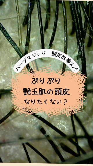 30代を過ぎたらお肌同様頭皮のケアもしましょう^_^
ハーブマジック、ベルジュバンスどちらのスパも頭皮改善に最適なスパです。 