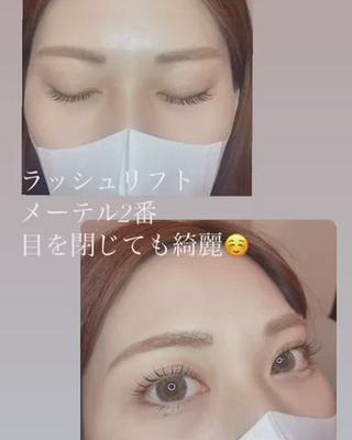 メーテルロッド♪
ラッシュリフト 