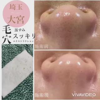 private salon  Dea_maris シュガーリング＆パーソナルボディケア所属・シミ改善・韓国肌管理 ボディメイク痩身のその他イメージ