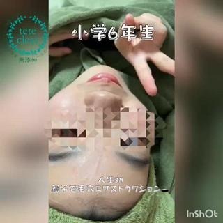 キッズ private salon  Dea_maris シュガーリング＆パーソナルボディケア所属・シミ改善・韓国肌管理 ボディメイク痩身のその他イメージ