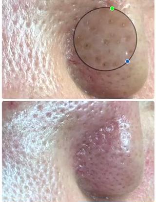 private salon  Dea_maris シュガーリング＆パーソナルボディケア所属・シミ改善・韓国肌管理 ボディメイク痩身のその他イメージ