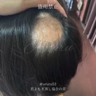 private salon  Dea_maris シュガーリング＆パーソナルボディケア所属・シミ改善・韓国肌管理 ボディメイク痩身のその他イメージ