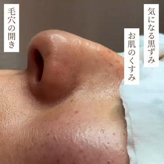 毛穴専門サロン ライカブルーのエステ・リラクイメージ