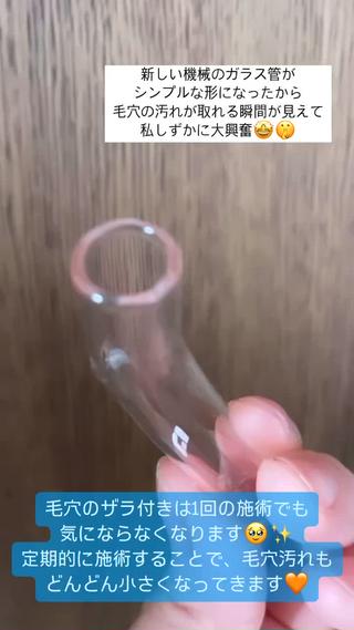 毛穴の汚れがスッキリ 