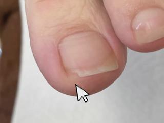 割れた爪も元通り 