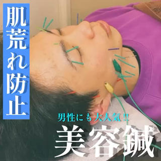 肌荒れ防止美容鍼 