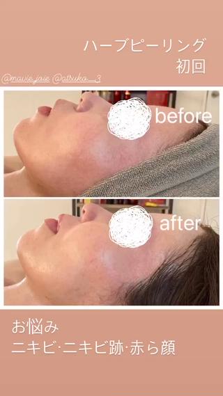 喜山 あつこのエステ・リラクイメージ