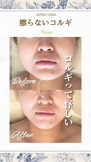 ＼コルギって怪しくない？／

𓆸𓂃◌𓈒𓏲
私もそう強く思っていたからこそ
『colan式擦らないコルギ』を作りました。

︎ 摩擦レスで繊細な肌を守る
︎ 表情筋や骨格のクセをしっかりゆるめる
︎ たるみ・シワ・肌荒れも改善
︎ 独自メソッドでナチュラルな小顔へ導く

atelier colanの擦らない小顔コルギ
（摩擦を最小限に抑える施術）で
安心・快適な美肌ケアを体験してください𓏸 𓐍 𓂃 
 