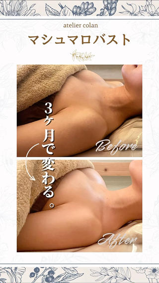 ＼3ヶ月で挑戦／
マシュマロバストアップ

atelier colanの
隠れロングセラーメニュー
バストのお悩み、
実はたくさん届いています᛭ ꙳ 

︎ 痩せたら小さくなった 
︎ 脇や腕に流れてきた気がする
︎ ハリがなくなった
︎ パートナーに褒められたい♡

atelier colanのバストアップメニューは
ご自身のポテンシャルを引き出しますʚ♡ɞ

︎ 背中・肩甲骨のコリを流す 
︎ 姿勢＆肋骨を整える 
︎ 自分の脂肪で自然にふっくら

「もともとないし…(諦)」とか
「もうこの歳だし…」と思っていた方にも
変化を実感いただいています𓏸 𓐍 𓂃 𓈒 