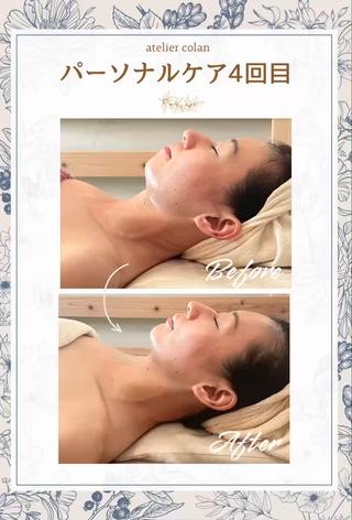 ＼プロも通うエステサロン／

エステティシャンさんって、
誰よりも美容を研究してて
いつも“誰か”のキレイのために動いてる。
だけど、そのぶん「自分のケア」は
ズボラになりがち…

atelier colanは、
そんな“職人肌”のあなたにも
お応えできるサロンです。

 背中デトックスリンパ
 擦らない小顔コルギ

美しさの土台を整えながら
なりたい理想像を一緒に描きます。

ぜひカウンセリングで教えてくださいね 