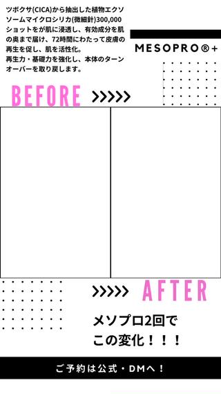 メソプロプラス2回目のビフォーアフターです！ 
