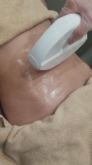 部分脱毛Mパーツお好きな箇所をチョイス♬ 