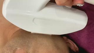 メンズヒゲ脱毛濃いヒゲ、薄いヒゲにも対応◎ 