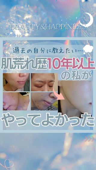 痩身ハーブピーリング 筋膜リリース☆B&Hのエステ・リラクイメージ