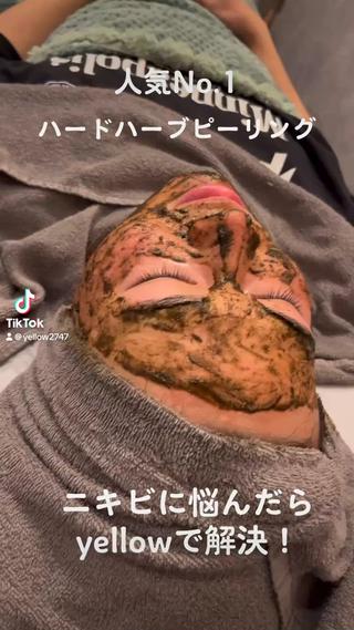 yellow“ハーブピーリング”ᩚ

ニキビ・ニキビ跡
毛穴
くすみ
しみ・しわ
などでお困りの方は、

yellowイエローへ

大阪市北区中崎西1-6-21 シティコーポ中崎305
070-1741-8944

#ハーブピーリング大阪#ハーブピーリング専門店
#剥離ありハーブピーリング#剥離なしハーブピーリング#芸能人ピーリング #ハーブピーリング中崎町#ニキビ#ニキビ跡#しみ#しわ#毛穴 #黒ずみ#たるみ#ツヤ肌#美肌#肌質改善#revi#芸能人美容#梅田エステサロン#エステ大阪#前撮り#卒業式#成人式#ブライダルエステ#ハーブピーリング梅田 