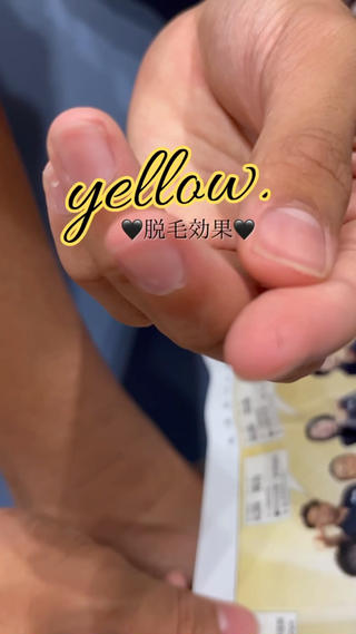 キッズ yellow.所属・yellow💛【 脱毛&フェイシャル】のエステ・リラクイメージ