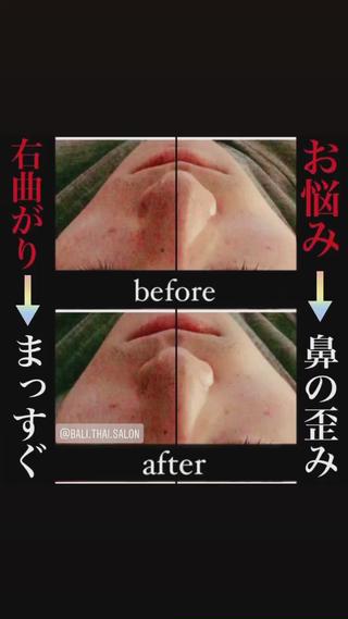 🌈歪み改善🌈 バリンタイ すぎうらのエステ・リラクイメージ