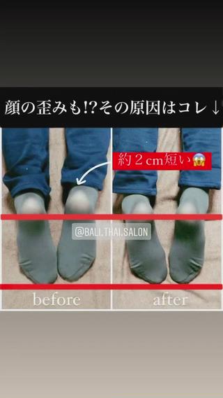 🌈歪み改善🌈 バリンタイ すぎうらのエステ・リラクイメージ