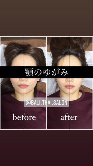 🌈歪み改善🌈 バリンタイ すぎうらのエステ・リラクイメージ