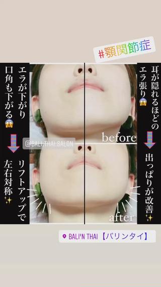 🌈歪み改善🌈 バリンタイ すぎうらのエステ・リラクイメージ