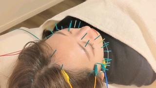 キュッとスッキリ小顔美容鍼。
頬周りのぽっこりほっぺや食いしばりにも◎
仕上げに引き上げヘッドマッサージと小顔マッサージでさらに引き締め 