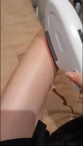 セルフ脱毛をする時は照射面をしっかりお肌につけてあげてくださいね
照射面が肌から離れていたりすると熱さを感じやすくなります。 