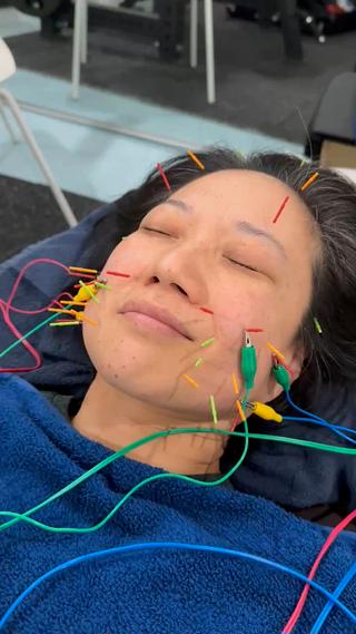 通電施術中の風景
 