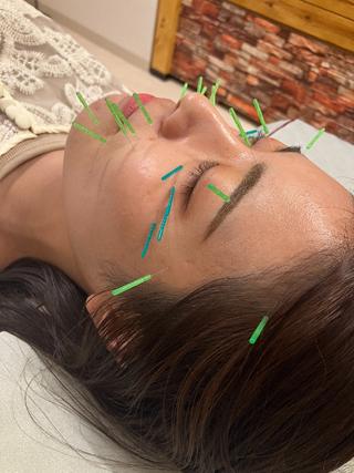 美容鍼なら頭痛・腰痛・肩こり専門【はしつね鍼灸整体院】都島院へ

インスタフォローして下さった方は２回目以降使用可能な１０００円引きクーポンプレゼント☆

来院時にフォローの画面を提示下さいね 