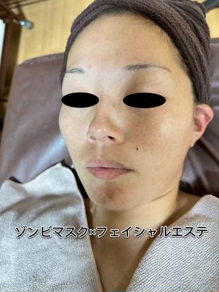 医療提携Beauty SalonMuseのエステ・リラクイメージ