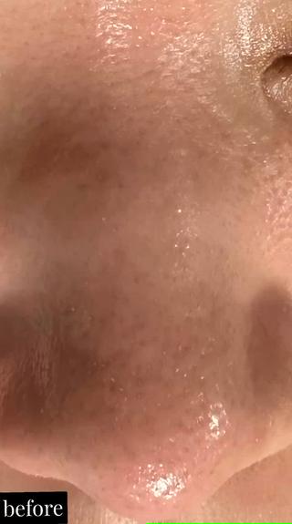 リピート率高めのメニューです

#井高野
 #自宅サロン
 #エステ 
 #肌質改善 
＃艶肌
＃ハリ感
＃シワ改善
 #完全予約制
 #ハイドラ
 #毛穴洗浄
 #毛穴レス
 #ハイドラフェイシャル
 #ハイドラフェイシャルエステ
＃ゾンビマスク
 #パック
 #上新庄
 #IZM
 #ラッシュアディクト
 #リップアディクト
 #美容
 #こだわり
 #スキンケア
 #毛穴特化
 #オールハンドエステ
 #美容マニア
 #長女
 #姉妹
 #美容姉妹
 #メイク 