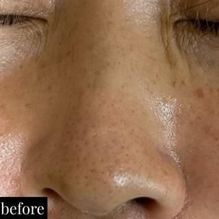 シワ・艶肌・ハリに効果的
美容が好きな方は特に1度すると
リピート率高めのメニューです

#井高野
 #自宅サロン
 #エステ 
 #肌質改善 
＃艶肌
＃ハリ感
＃シワ改善
 #完全予約制
 #ハイドラ
 #毛穴洗浄
 #毛穴レス
 #ハイドラフェイシャル
 #ハイドラフェイシャルエステ
＃ゾンビマスク
 #パック
 #上新庄
 #IZM
 #ラッシュアディクト
 #リップアディクト
 #美容
 #こだわり
 #スキンケア
 #毛穴特化
 #オールハンドエステ
 #美容マニア
 #長女
 #姉妹
 #美容姉妹
 #メイク 