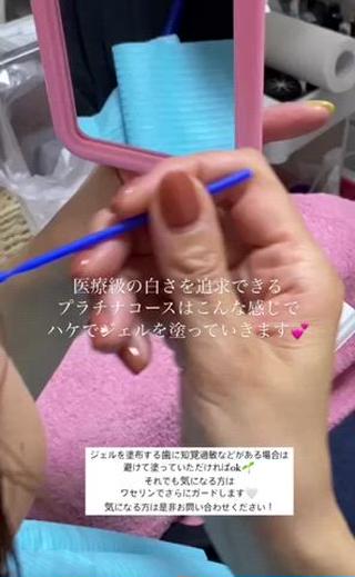 ネイル/耳つぼ /新ホワイトニングのネイルデザイン