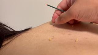 【おきゅうの様子】
体を温めて血流改善を促していきます。リラックス効果もあり夏場の冷房対策として有効です。
特に冷えやすい足周りに行うとより良いです！
お線香のような香りがしています。 