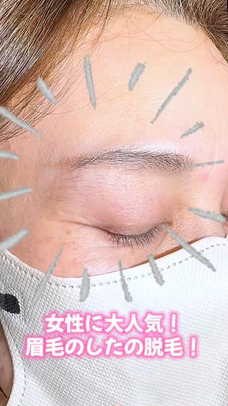 女性 眉毛脱毛