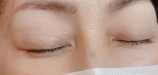 次世代まつげパーマラッシュリフト

立ち上げデザインは最大限自まつ毛を長く見せます
瞼も1〜2mm上がり、まつ毛が瞳に影を作らないので
自分史上最大のぱっちりお目元が実現します！ 