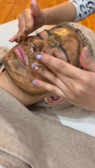 ハーブピーリング剥離あり
皮向けありのダウンタイムがある分、1回でツルピカお肌へ 