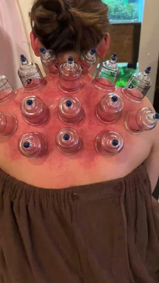 首・肩 かっさ&カッピング 